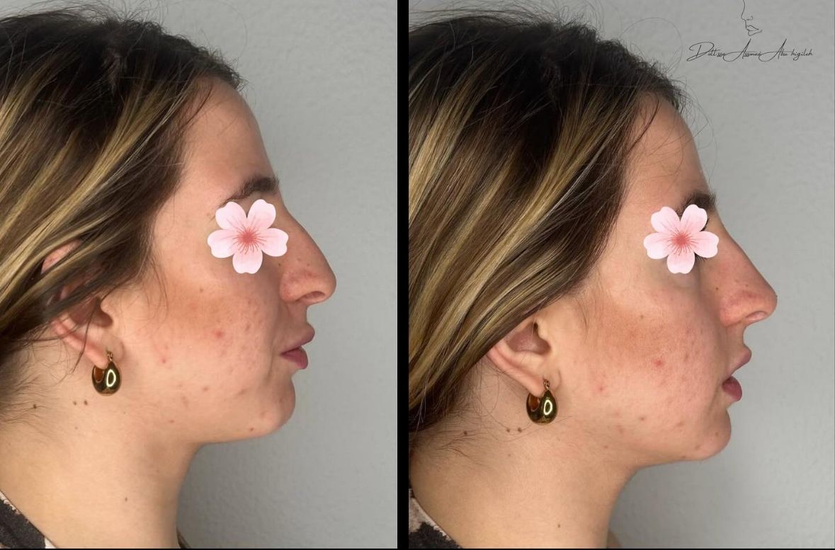 Assmaà Abu Higileh-8