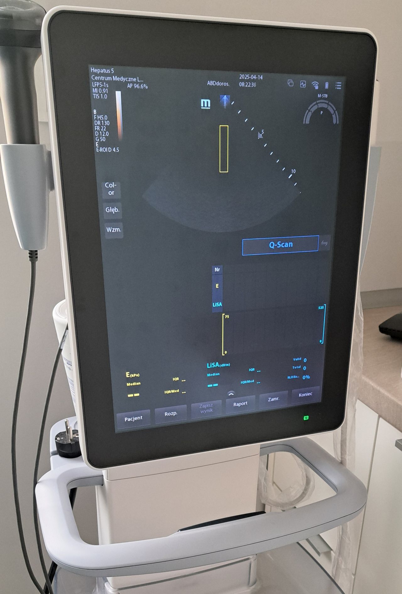 Fibroscan Centrum Medyczne L4Med -0