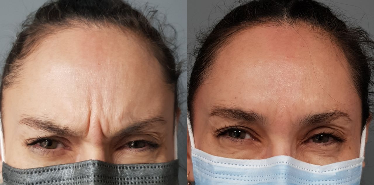 Rosalba Herrero Zerpa-114