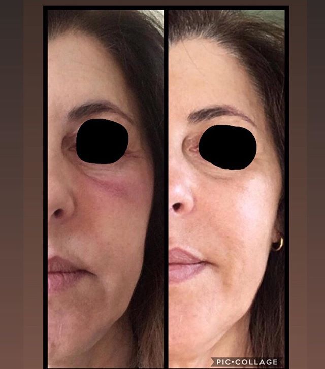 Olane Guergue Diaz De Cerio-9