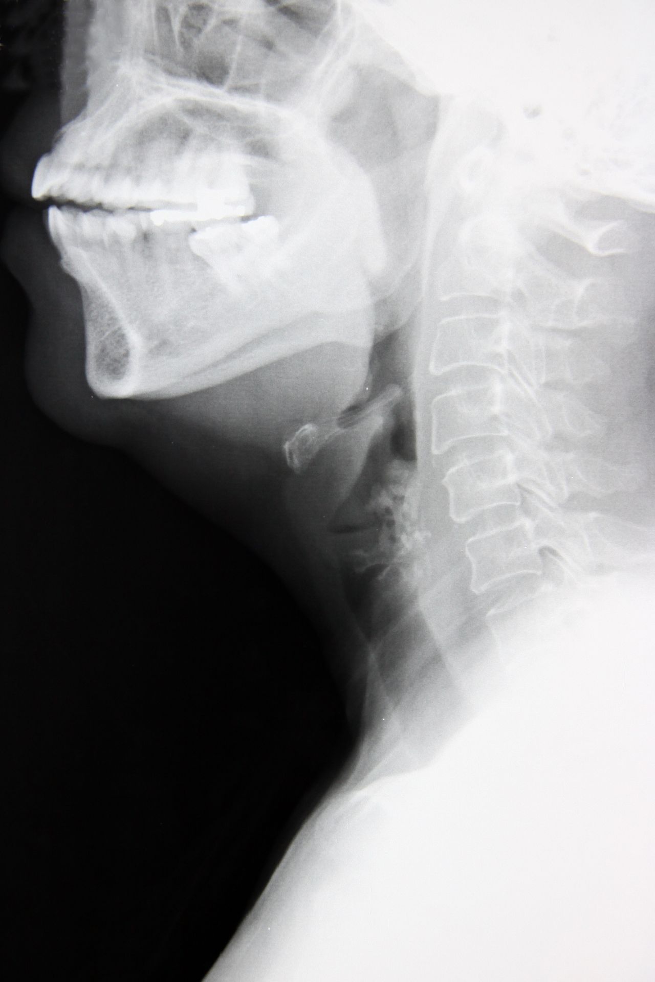 Alessandro Palumbo-53