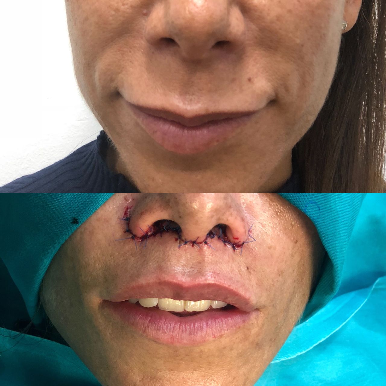 Alberto Candau Álvarez-21