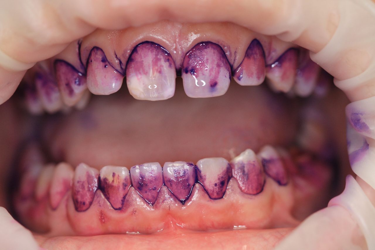 Paulina Sawicka-Soszyńska-34