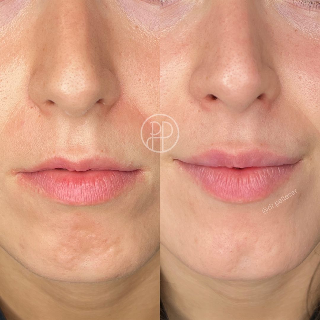 Liliana Paola Pellecer Ruiz-8