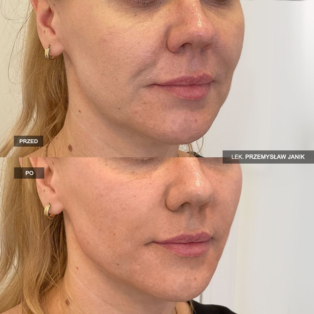 Przemysław Janik-33