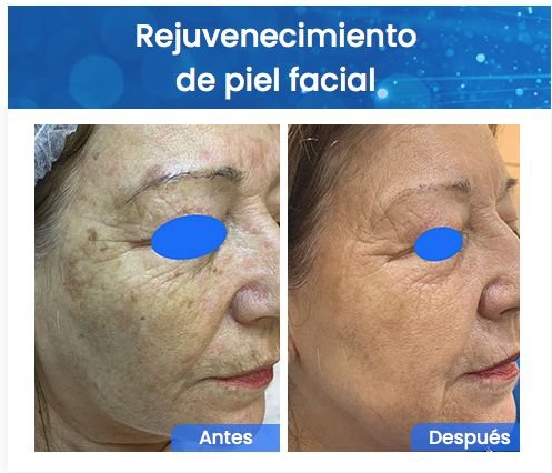 Juan Enrique Pérez Enríquez-146