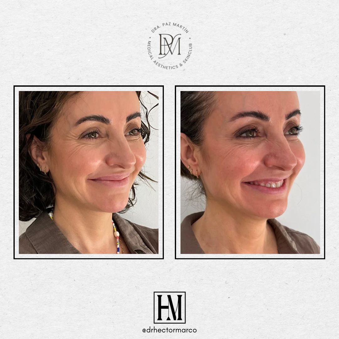 Héctor Marco Ruiz-10