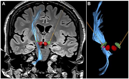 Javier Abril Jaramillo-12