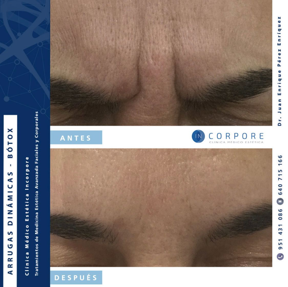 Juan Enrique Pérez Enríquez-111