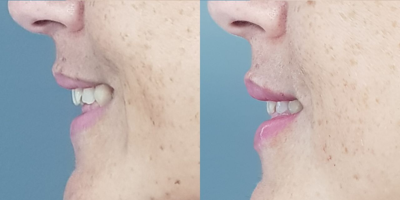 Rosalba Herrero Zerpa-166