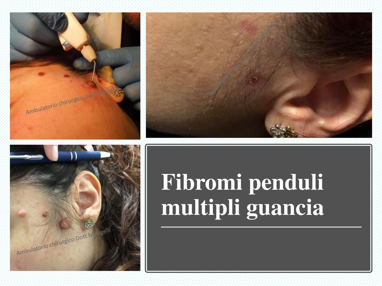 Matteo Antonio Mongelli-22