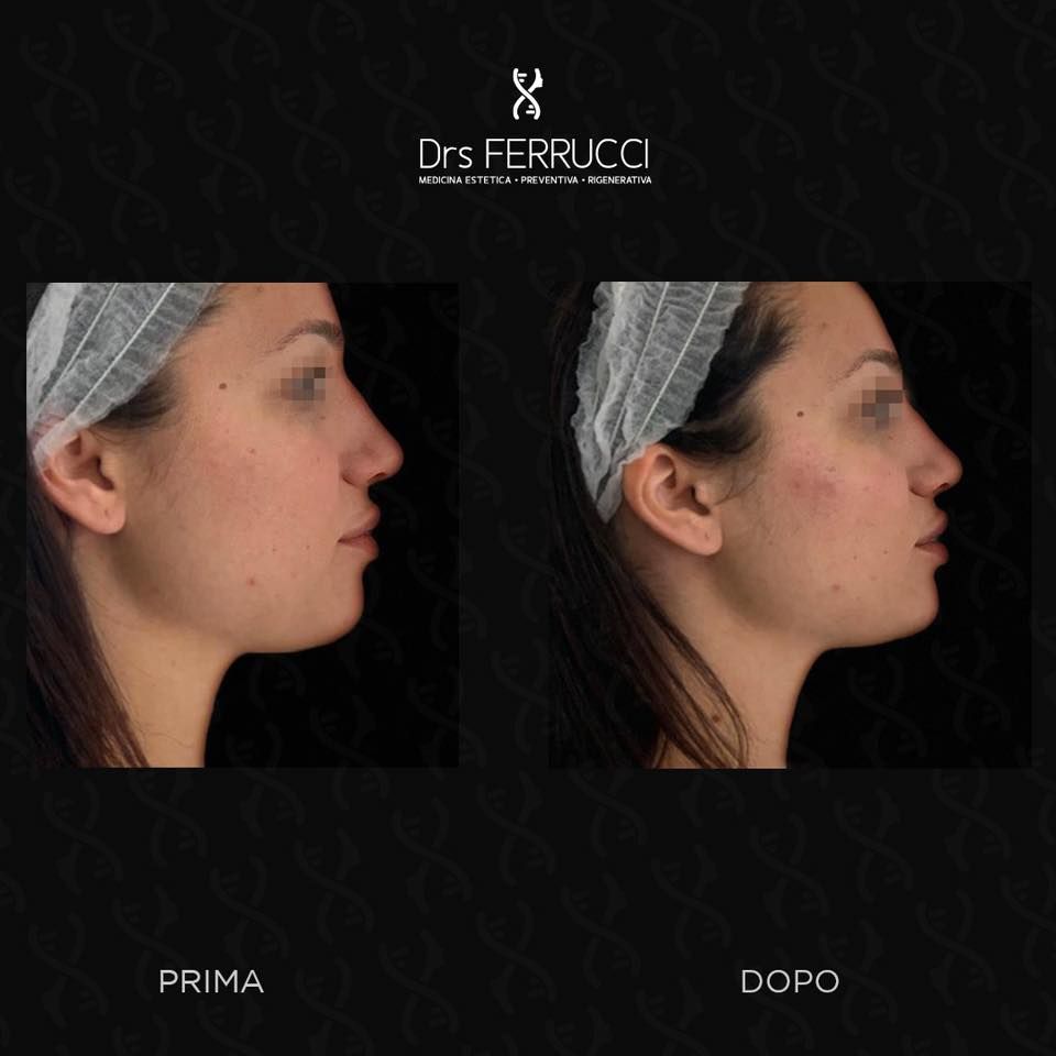 Giuseppe Ferrucci-32