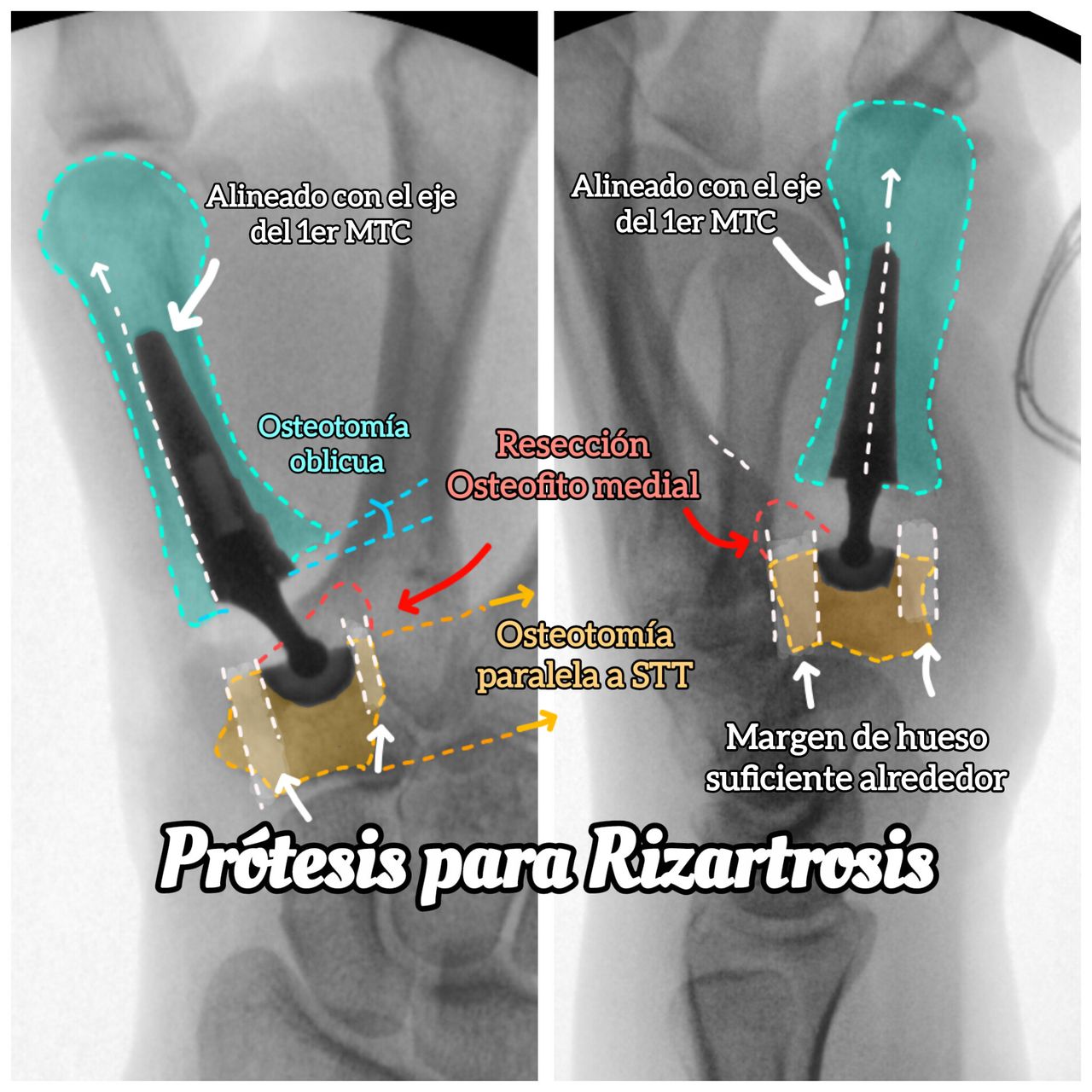 Derlis Sotelo García-7