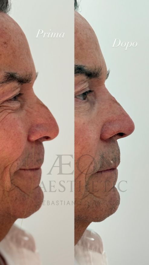 Sebastiano Di Lascio-5