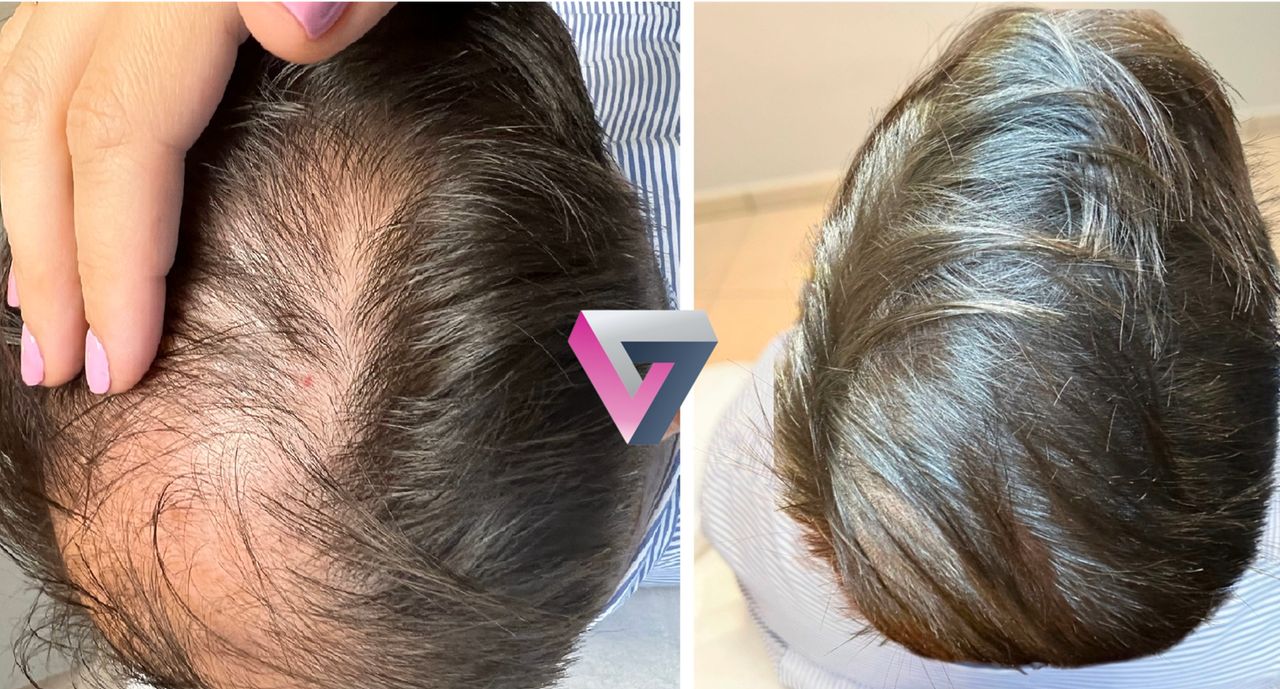 Victoria Trasmonte-77