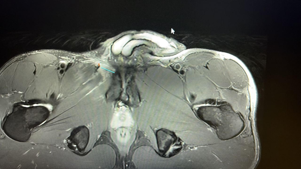 Filippo Della Martera-1