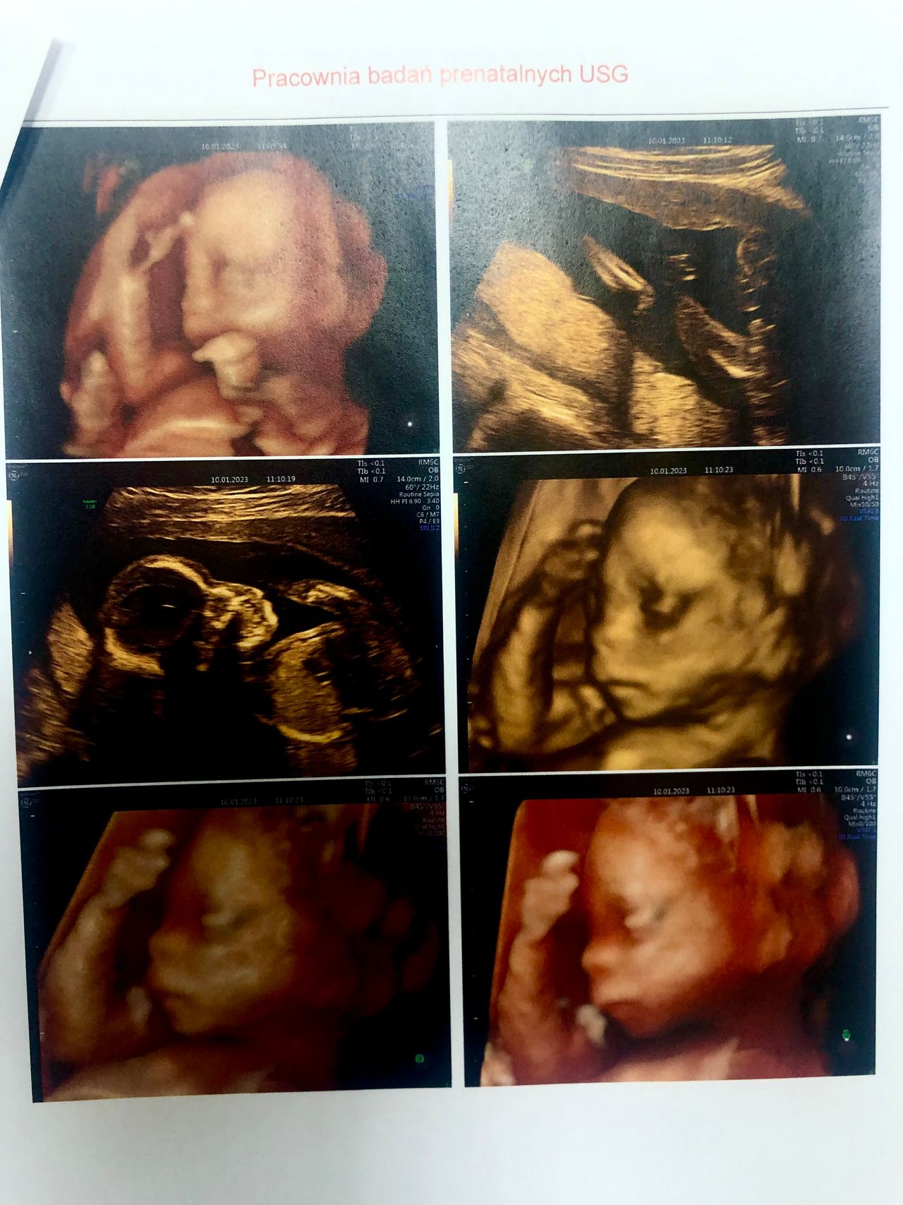 Wioletta Rozmus-Warcholińska-27