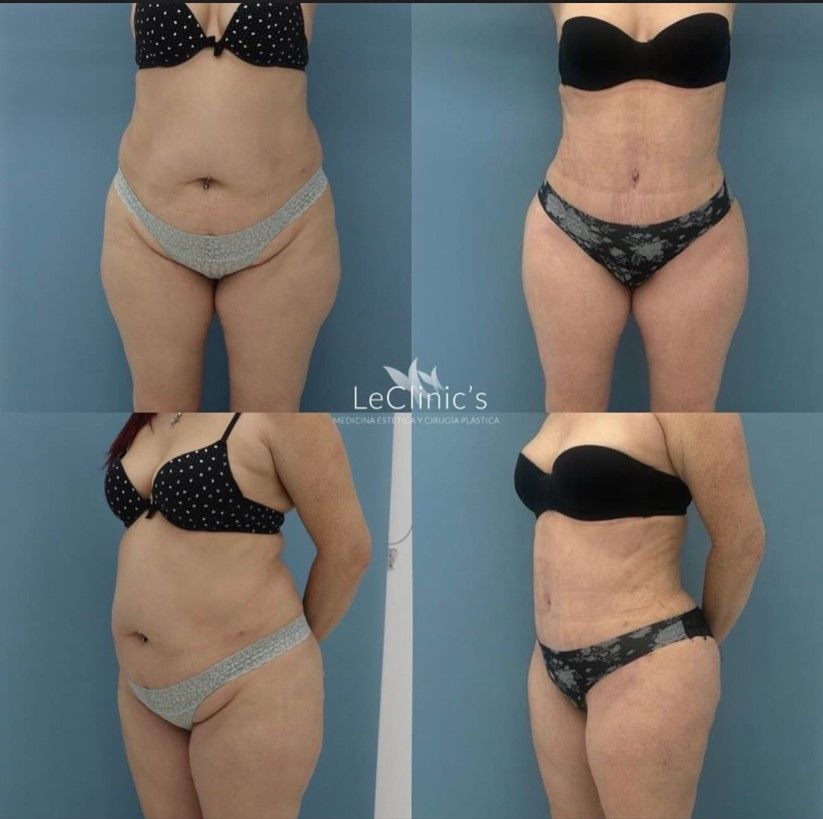 Carlos Corrales Benítez-12