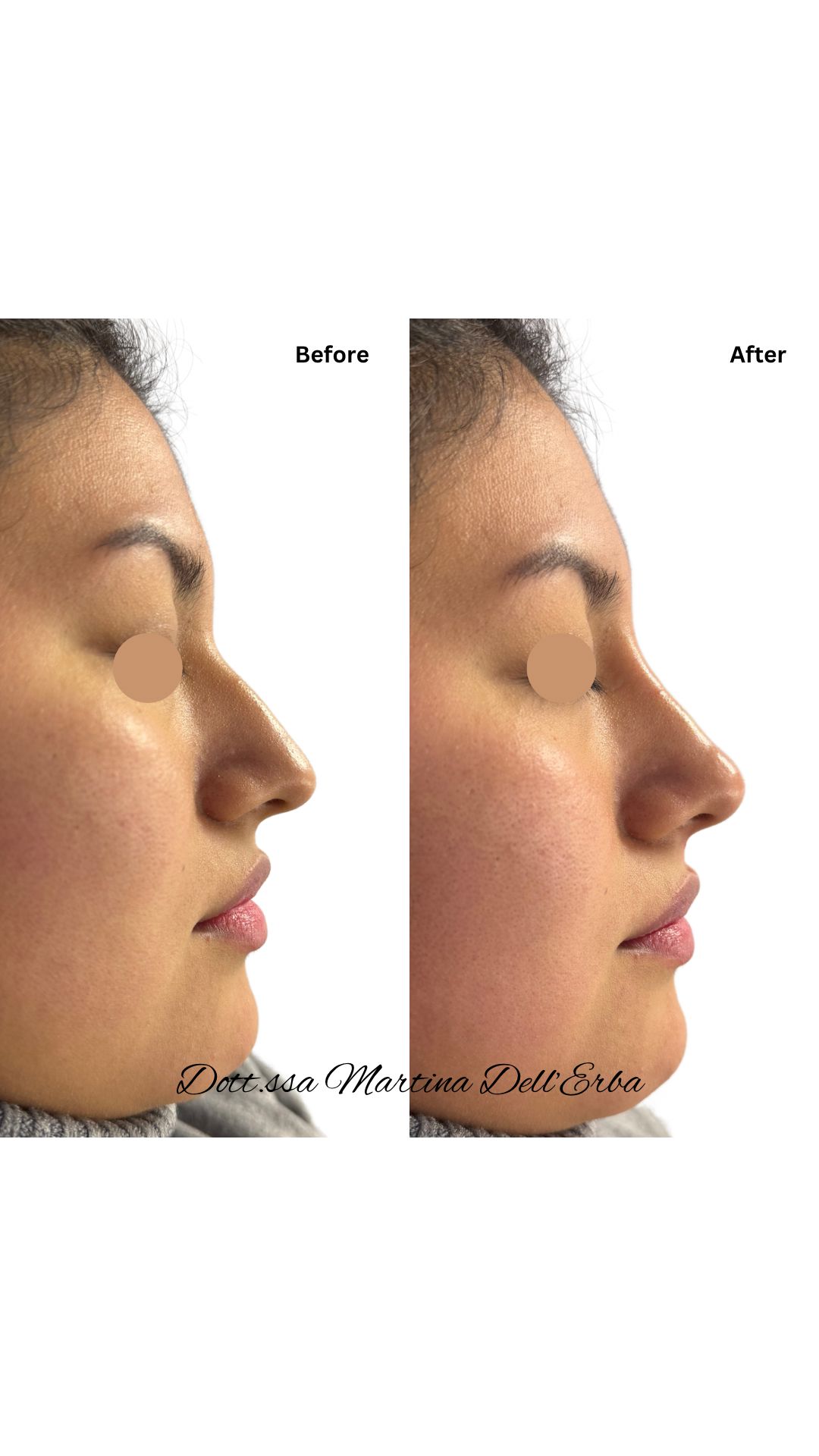 Martina Dell'erba-13