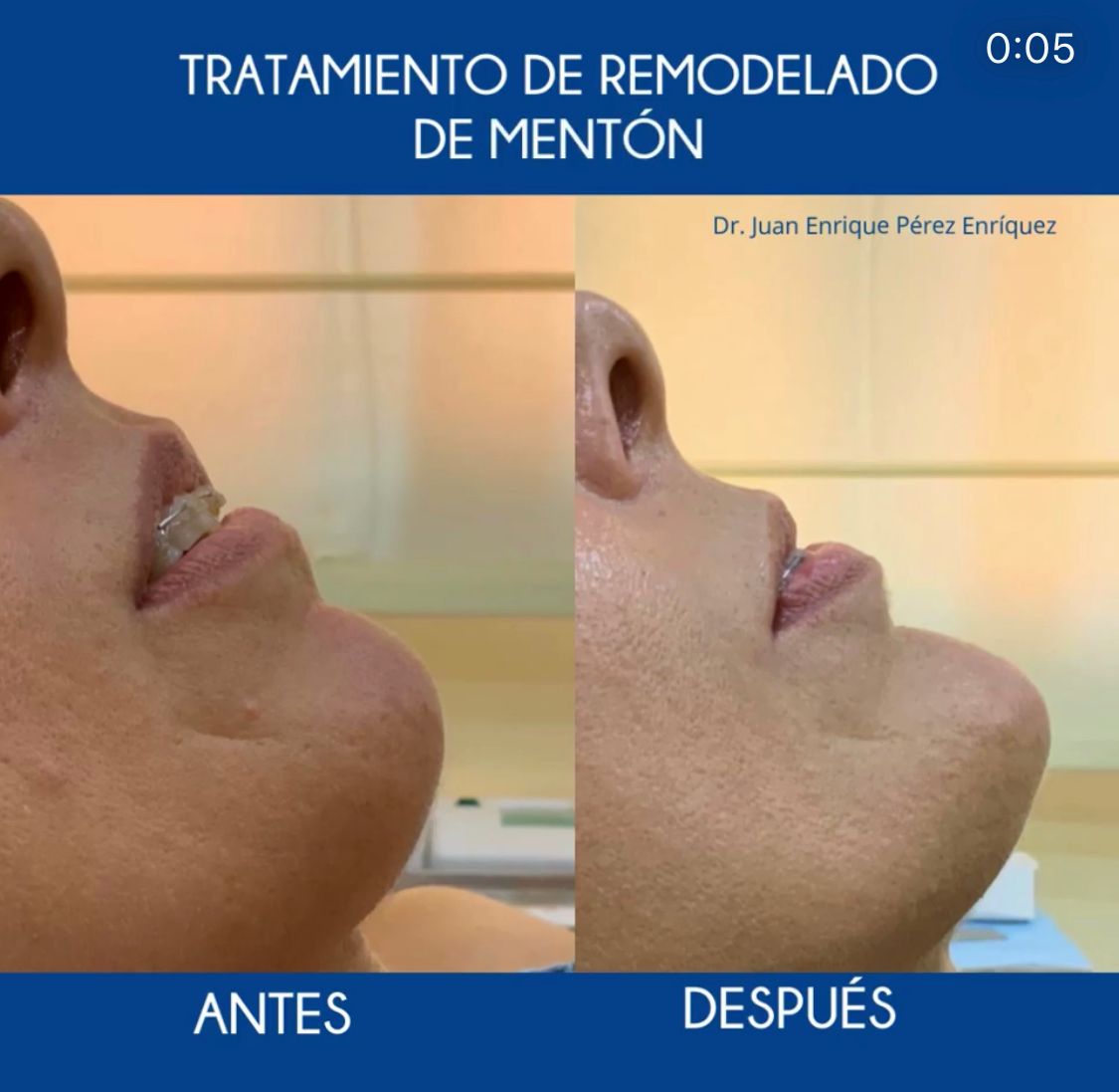 Juan Enrique Pérez Enríquez-24