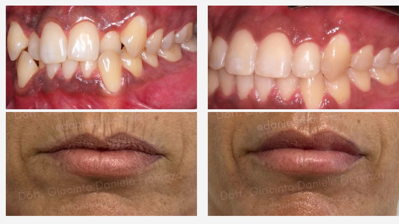 Giacinto Daniele Fiorenza-0