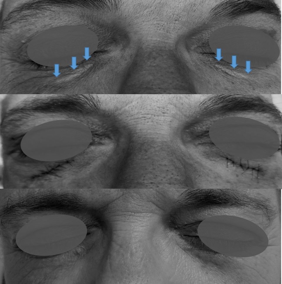 Telmo Xabier Lertxundi Plaza-11