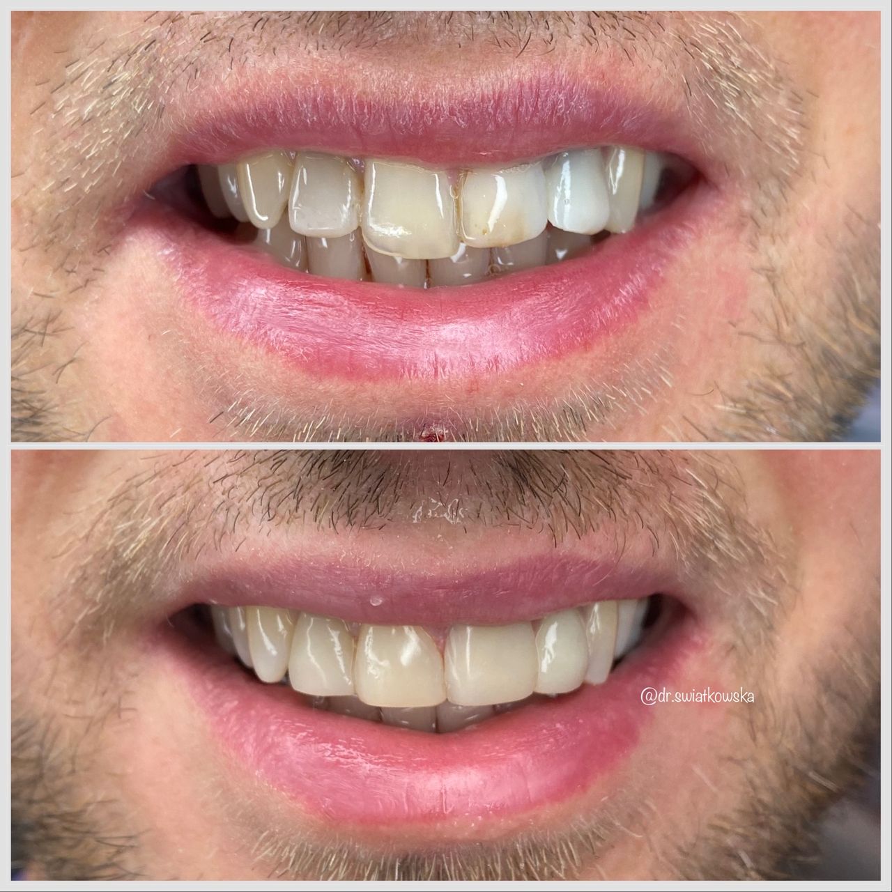 Angelika Świątkowska-18