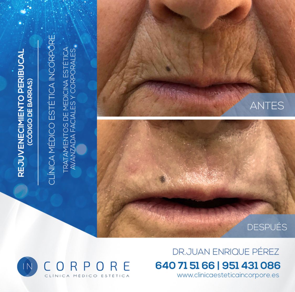 Juan Enrique Pérez Enríquez-92