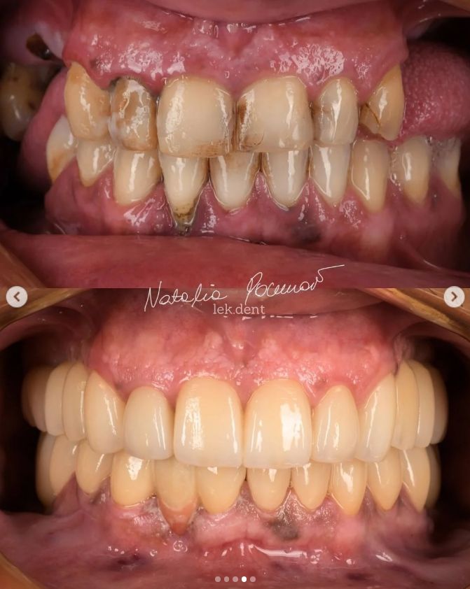 Natalia Pochroń-Sawka-5