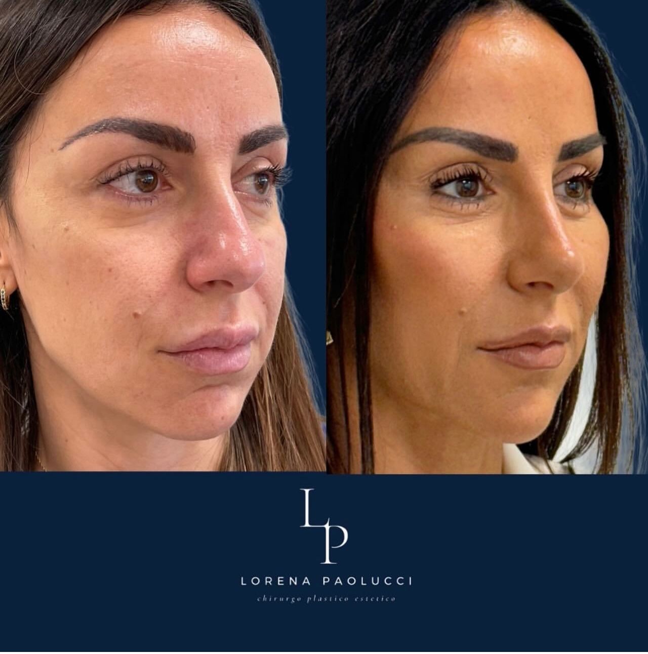 Lorena Paolucci-25