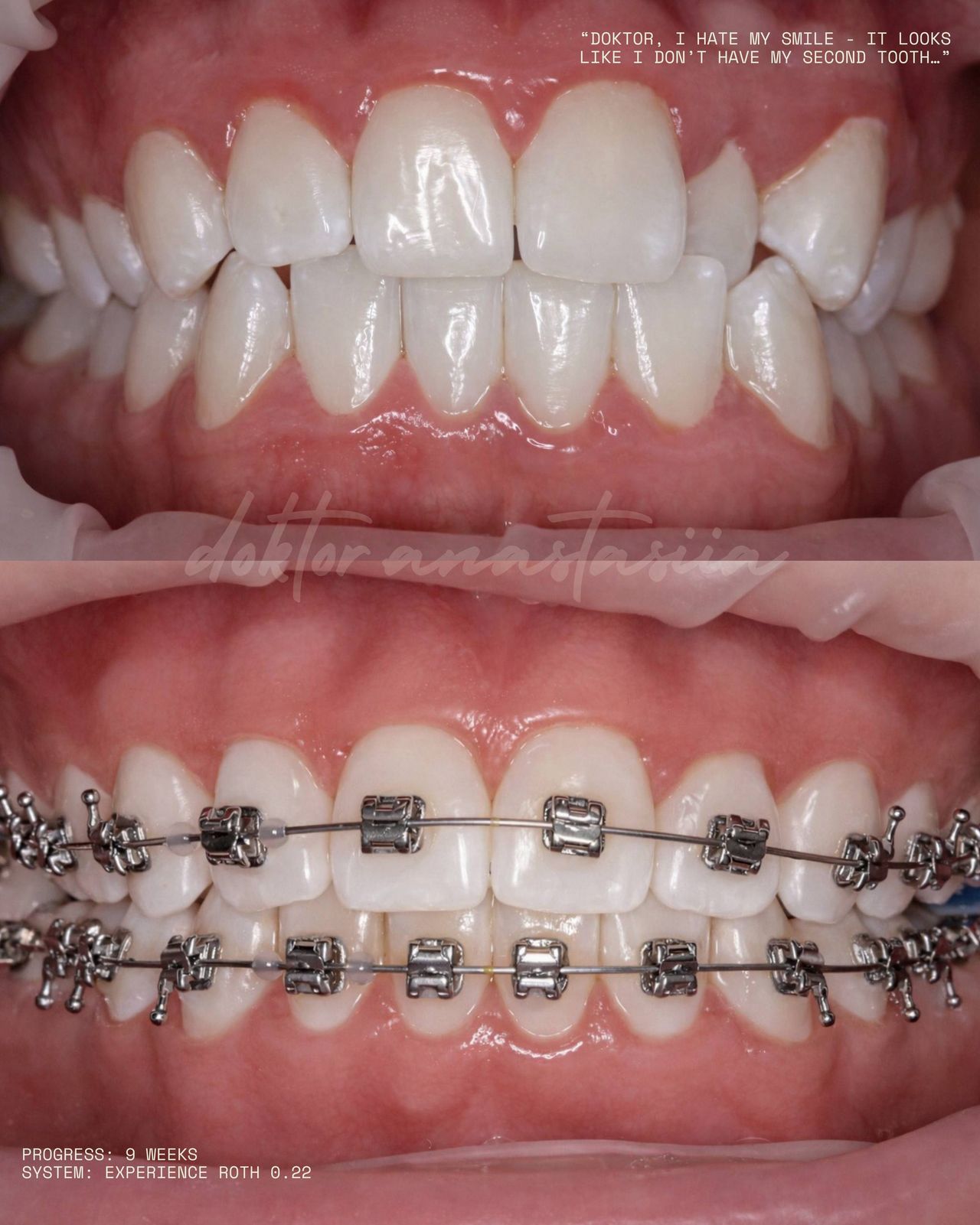 Anastasiia Malkina-2