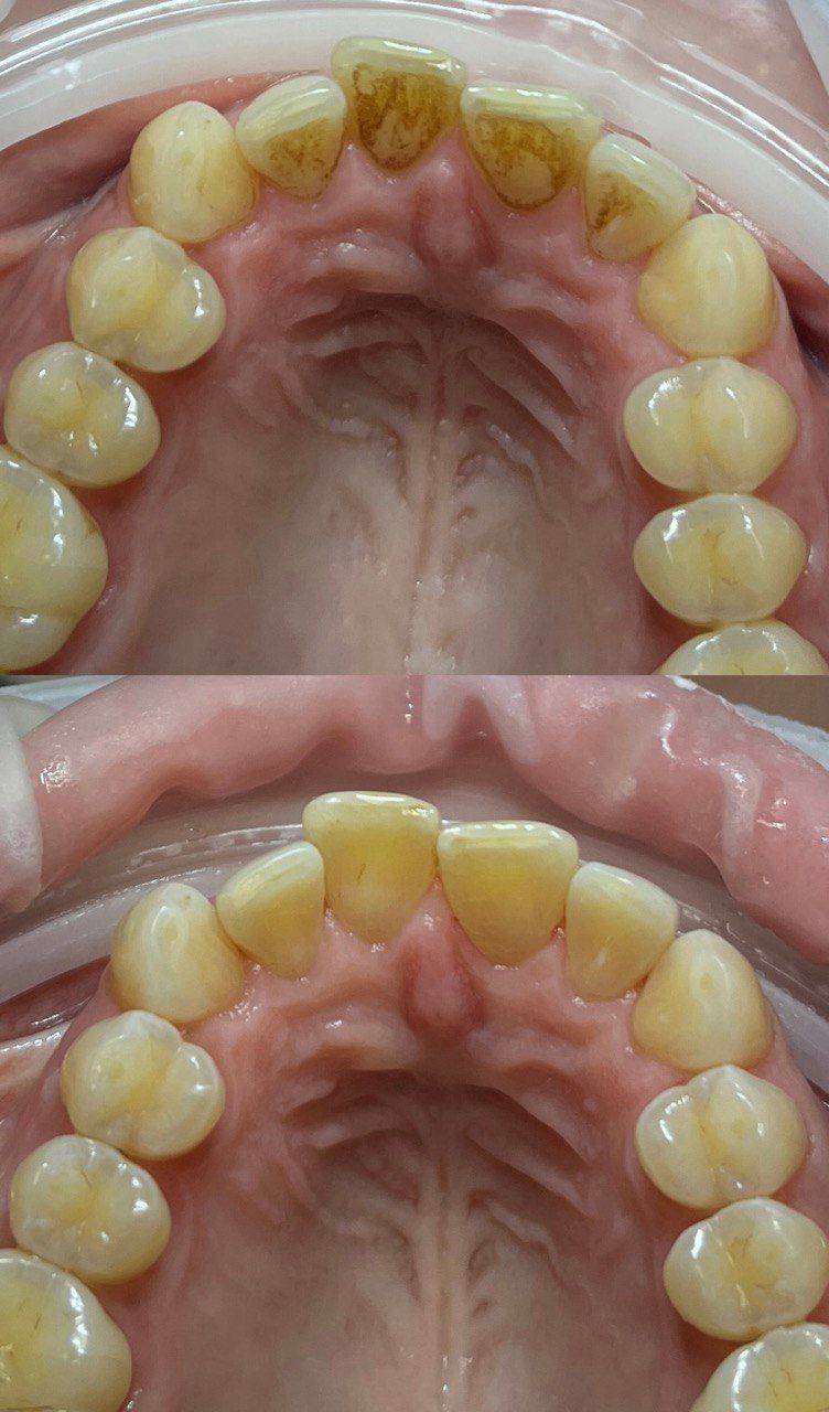 Tetiana Starodubets-9