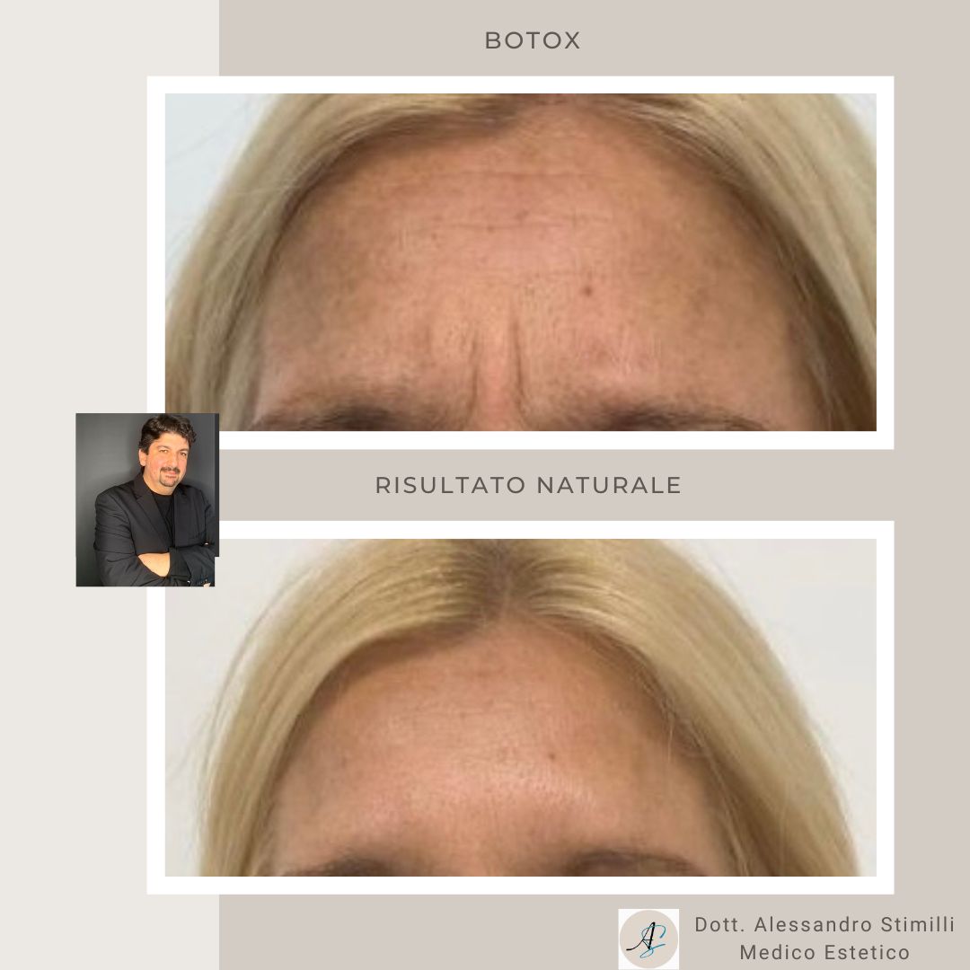 Alessandro Stimilli-7