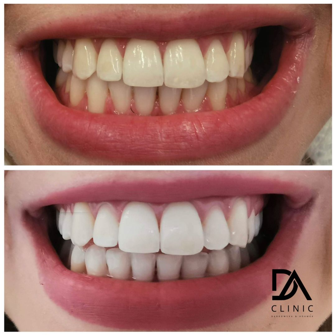 Agata Dąbrowska-Adamek-35