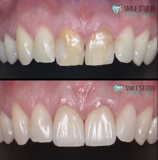 Michał Jankowski-23