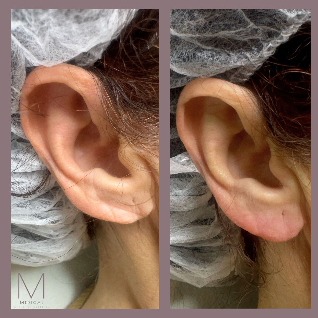 Marta Reyes Álvarez-11