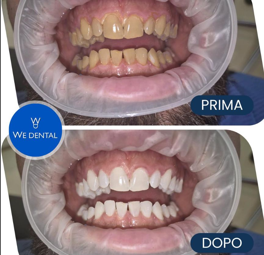 Federico D'alessio-5