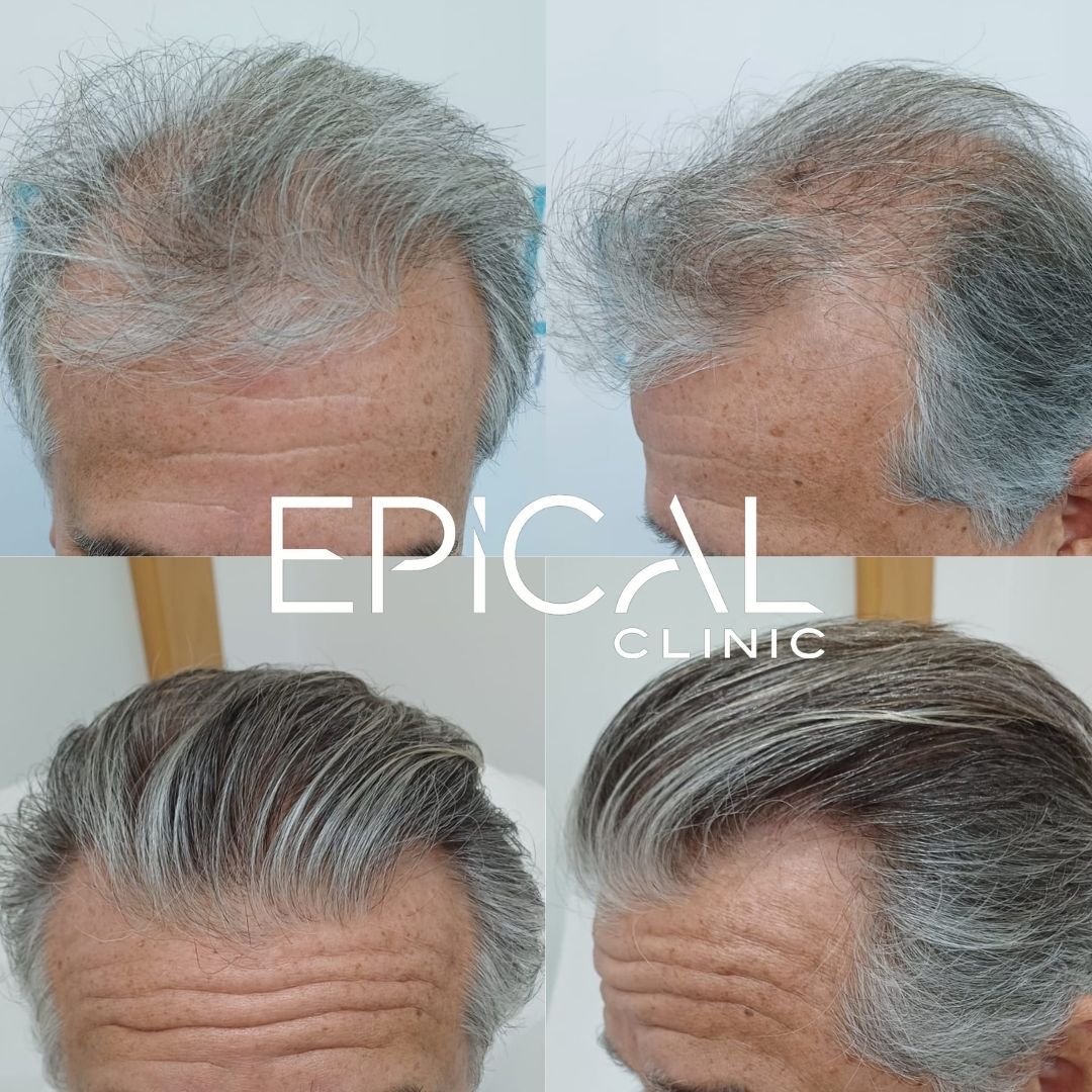 Juan Francisco Belén Montero-33