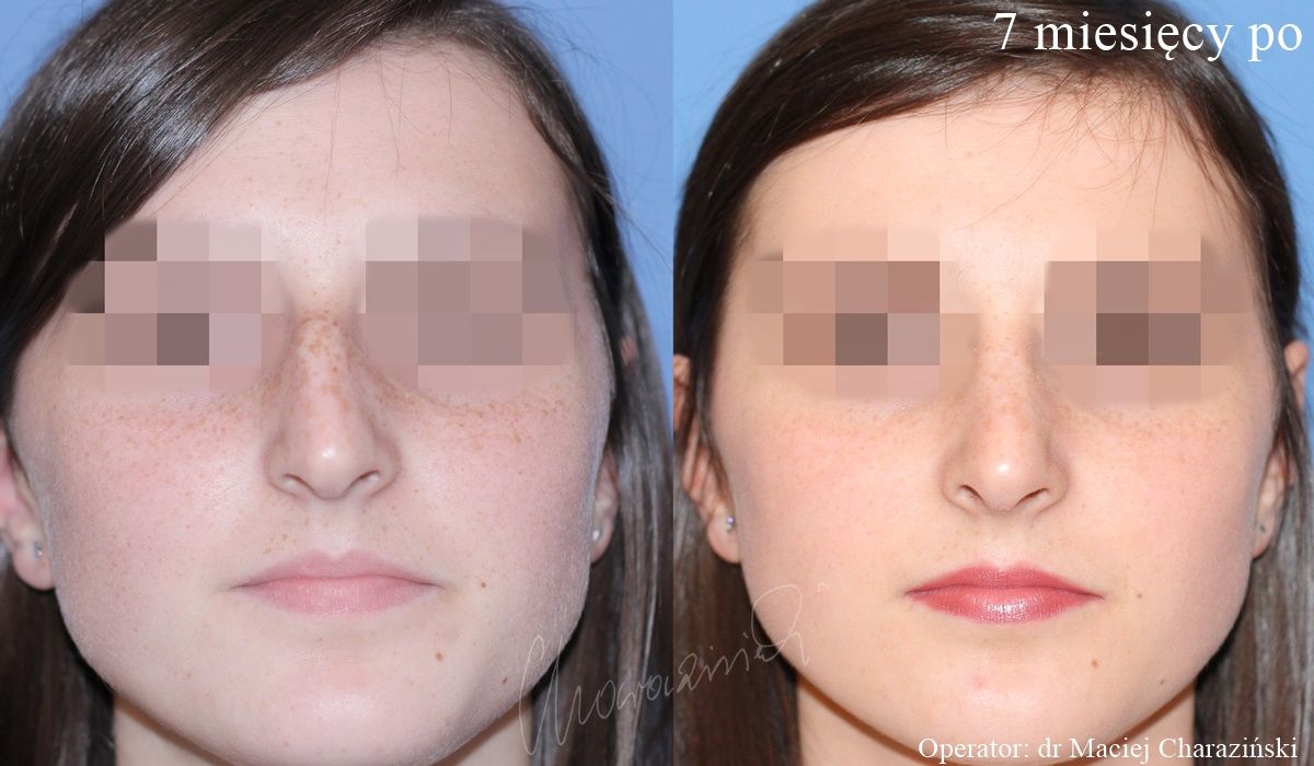 Maciej Charaziński-16