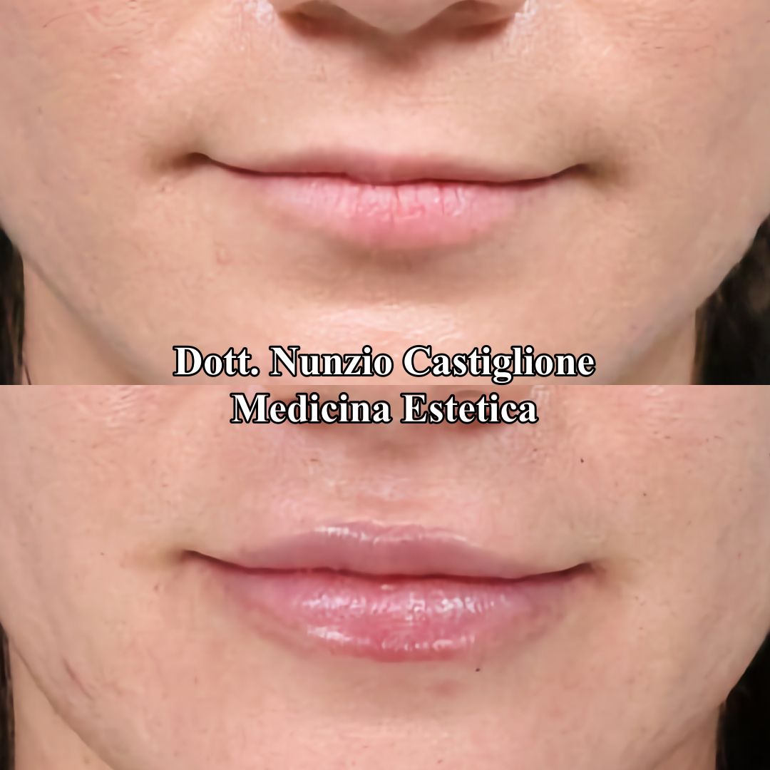 Nunzio Castiglione-6