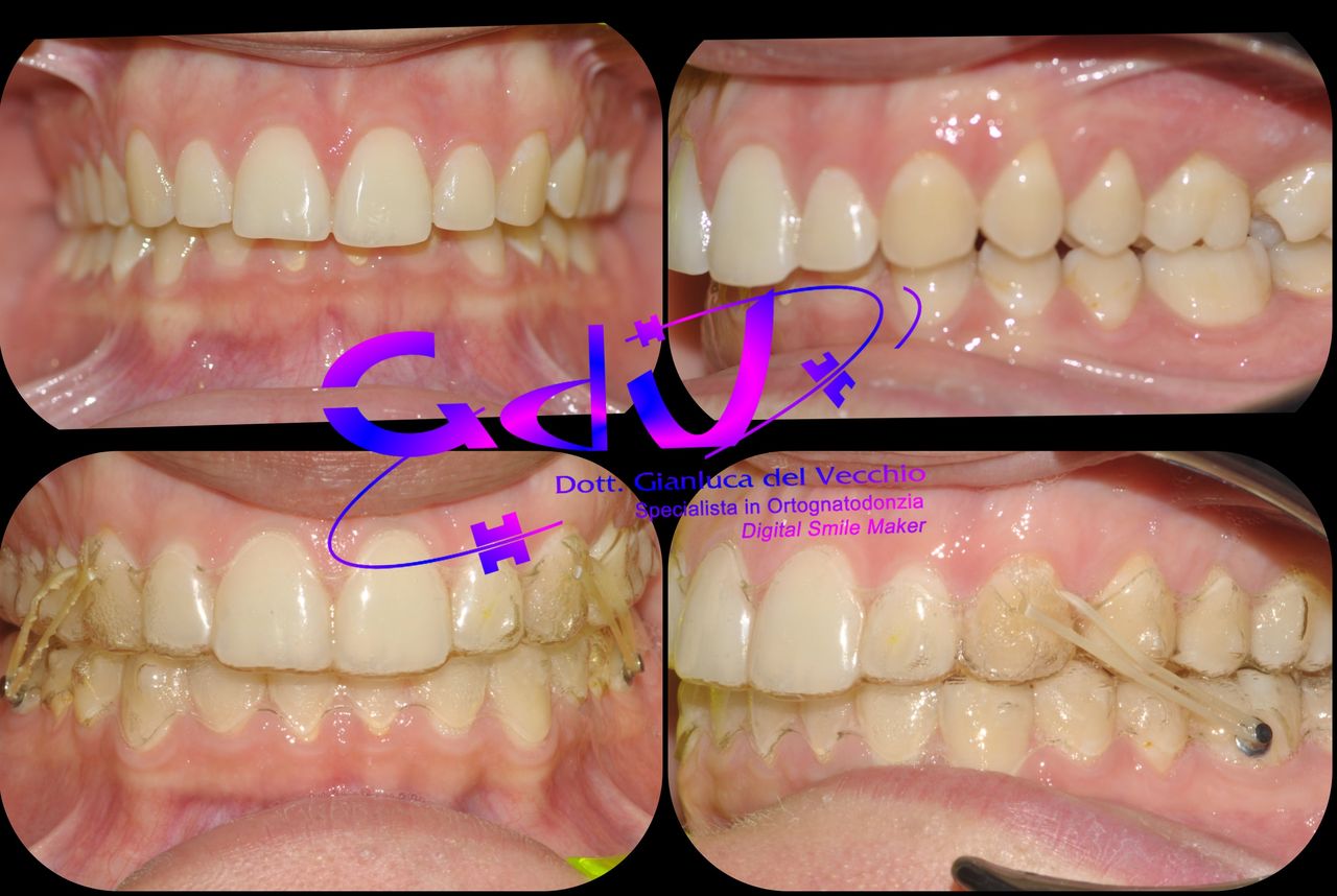 Gianluca Del Vecchio-129