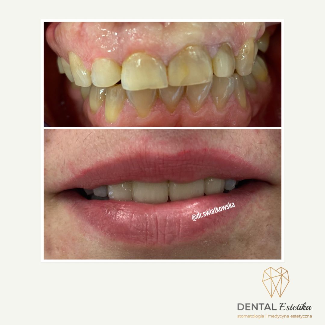 Angelika Świątkowska-16