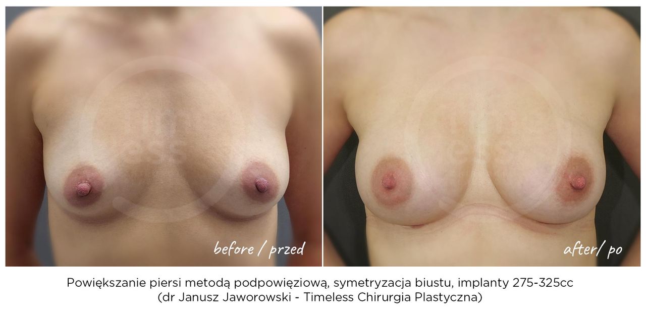 Janusz Jaworowski-158