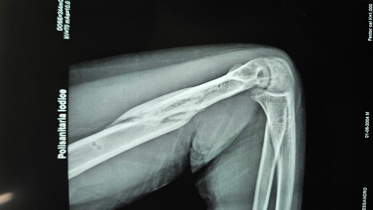 Gennaro Campopiano-9