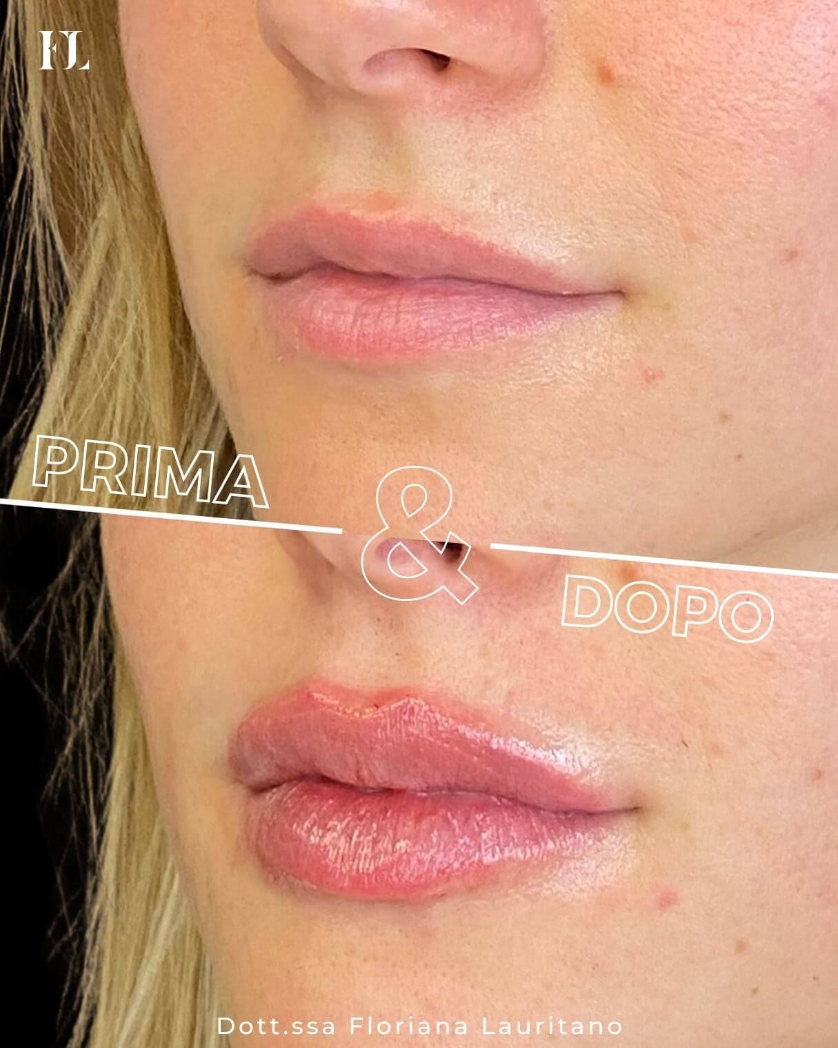 Floriana Lauritano-31