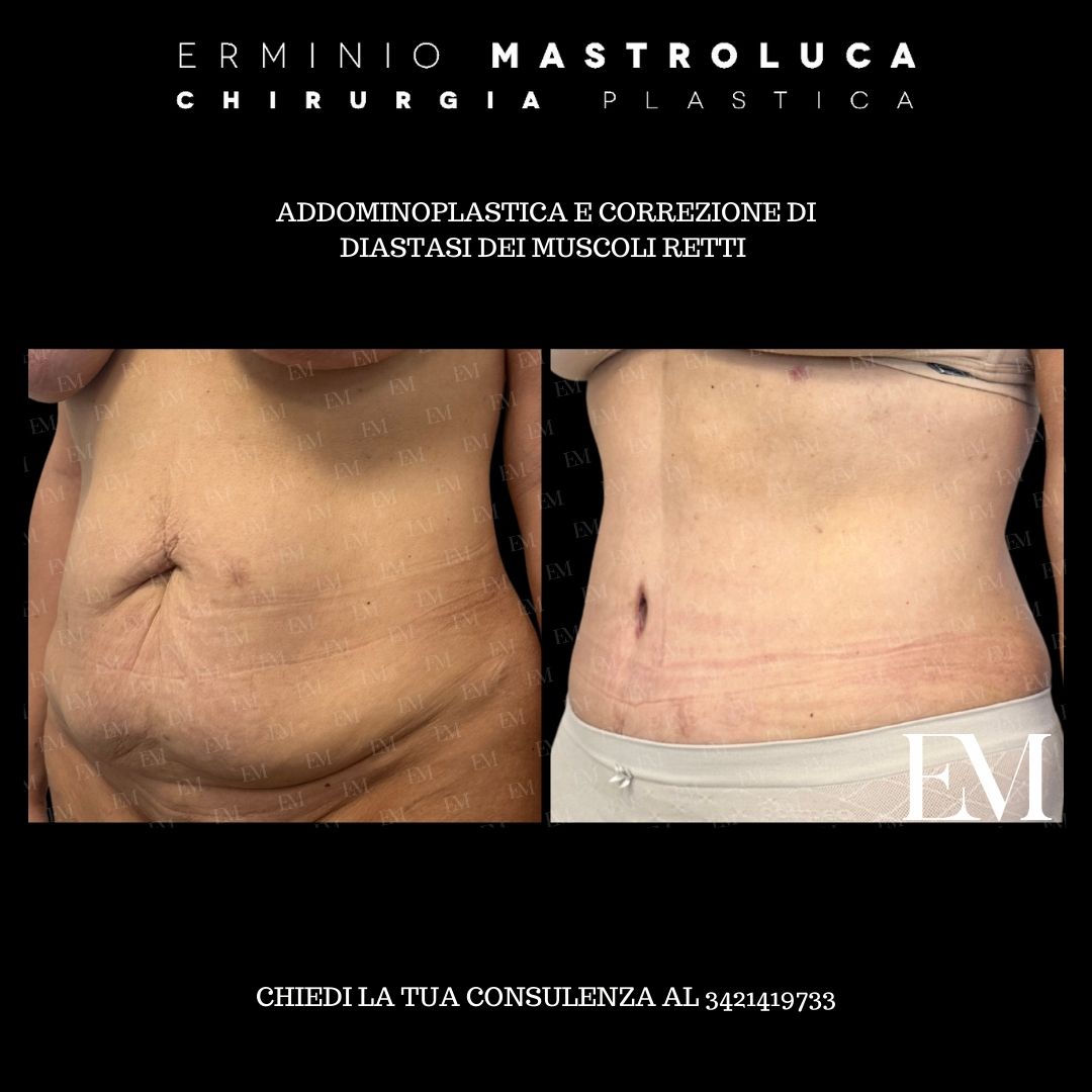 Erminio Mastroluca-10