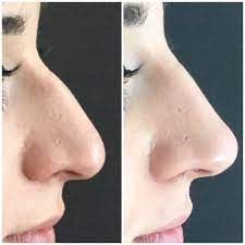 Paolo Bastianelli-34