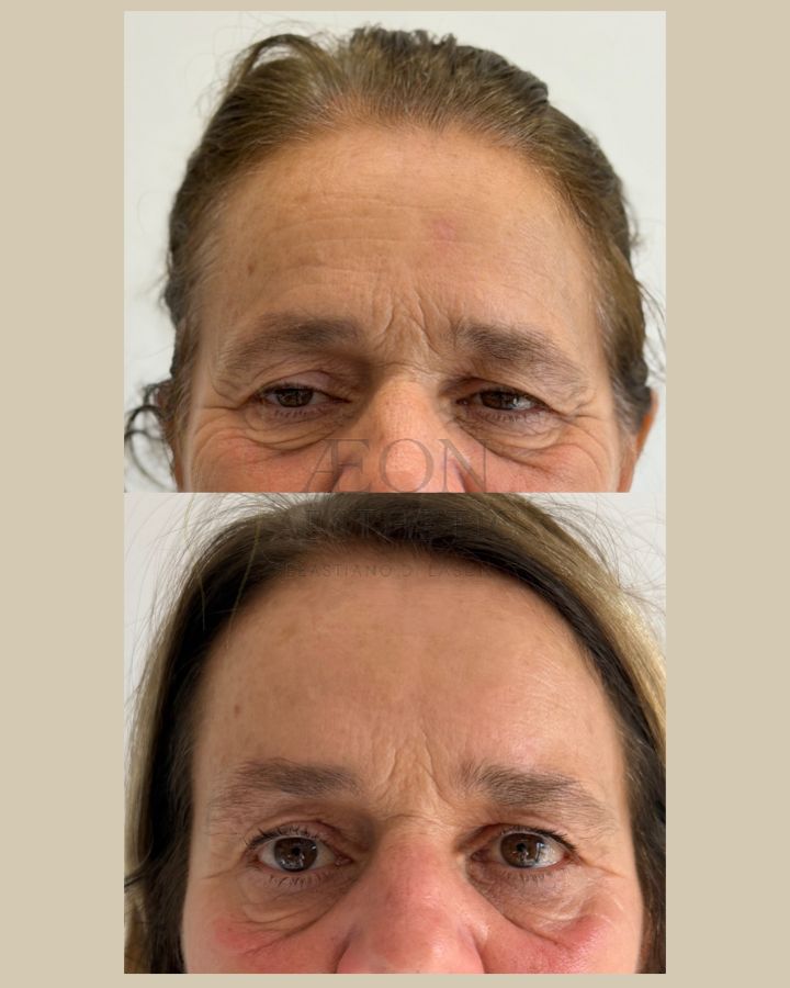 Sebastiano Di Lascio-15