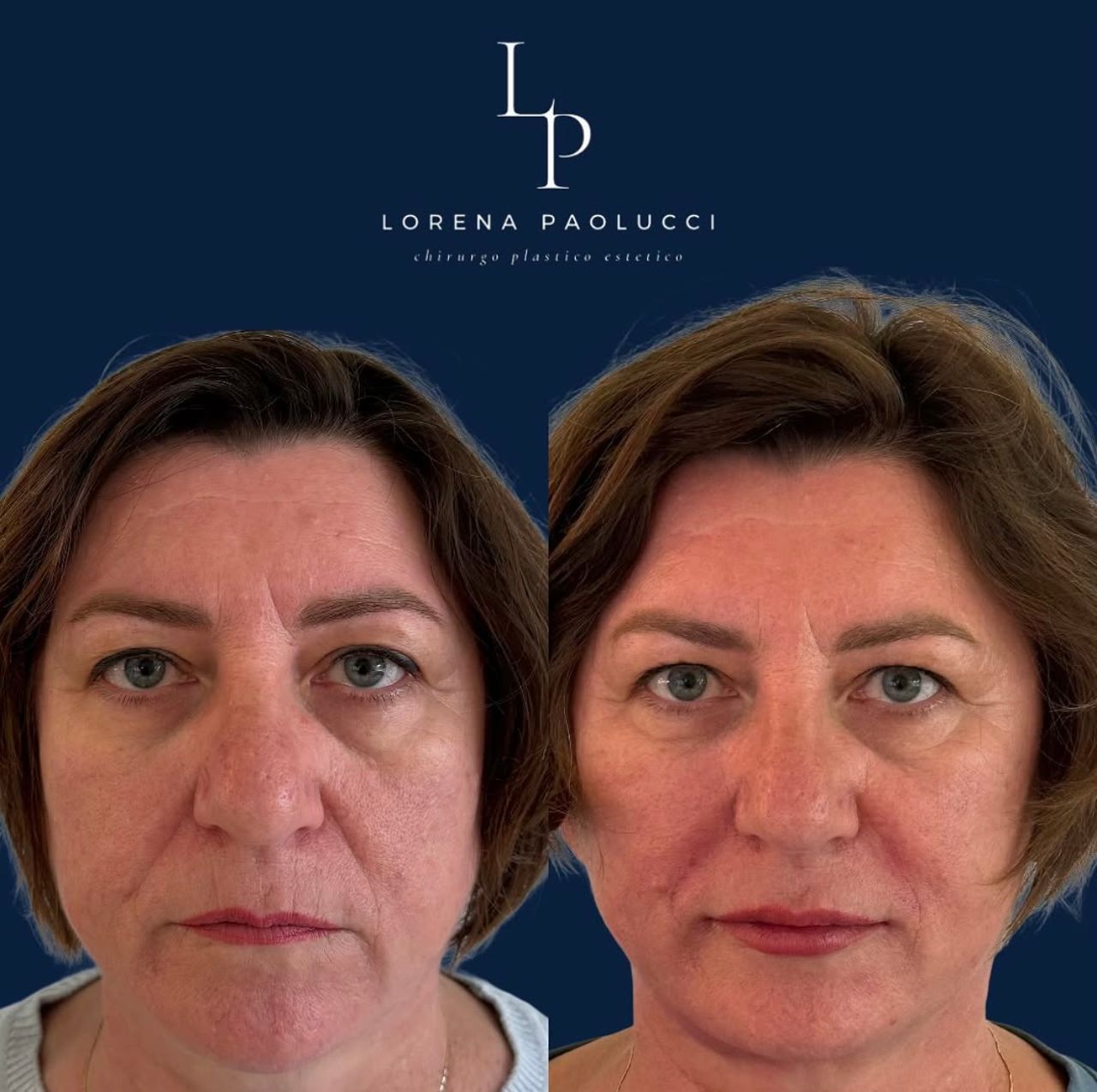 Lorena Paolucci-45