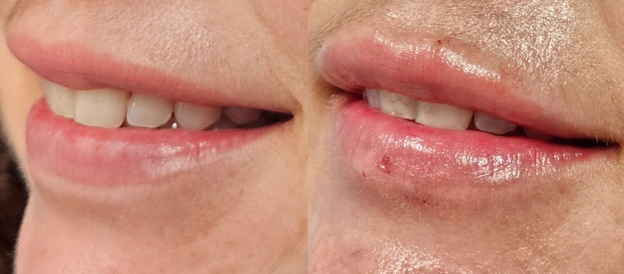 Rosalba Herrero Zerpa-558